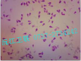 賈第蟲滋養(yǎng)體